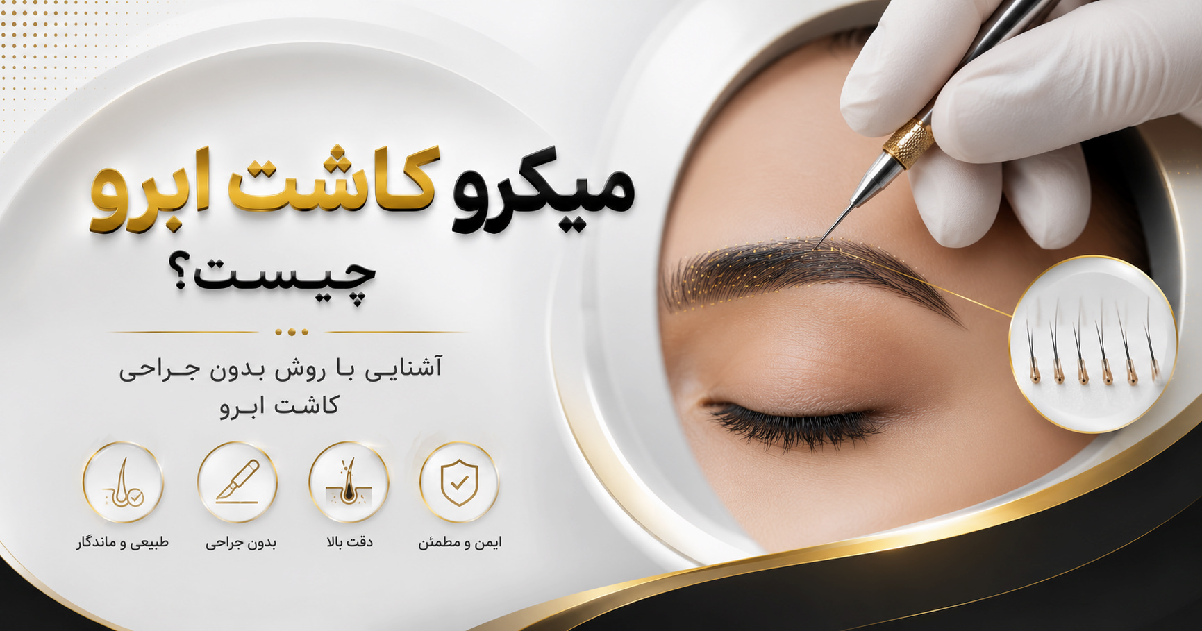 میکروکاشت ابرو به روش بدون جراحی با گرافت های تک فولیکولی